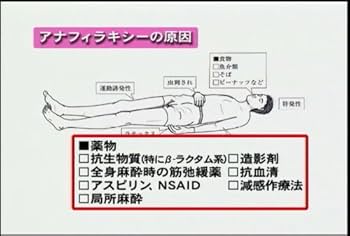 Dr.岡田のアレルギー疾患大原則(1)/ケアネットDVD